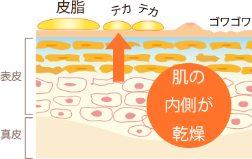 インナードライの肌